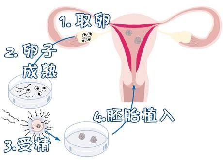男性因素案例